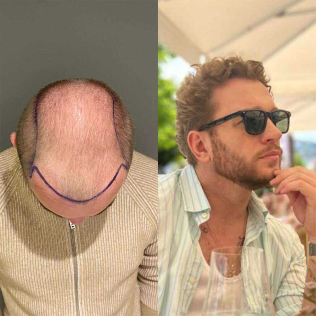 clínica estética en Albania